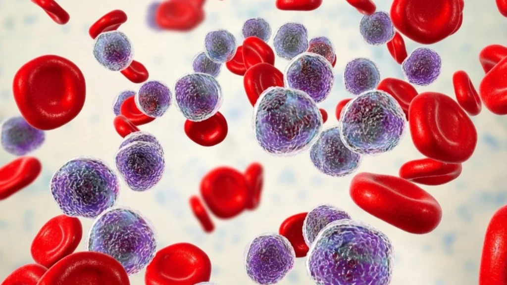 Leukaemia